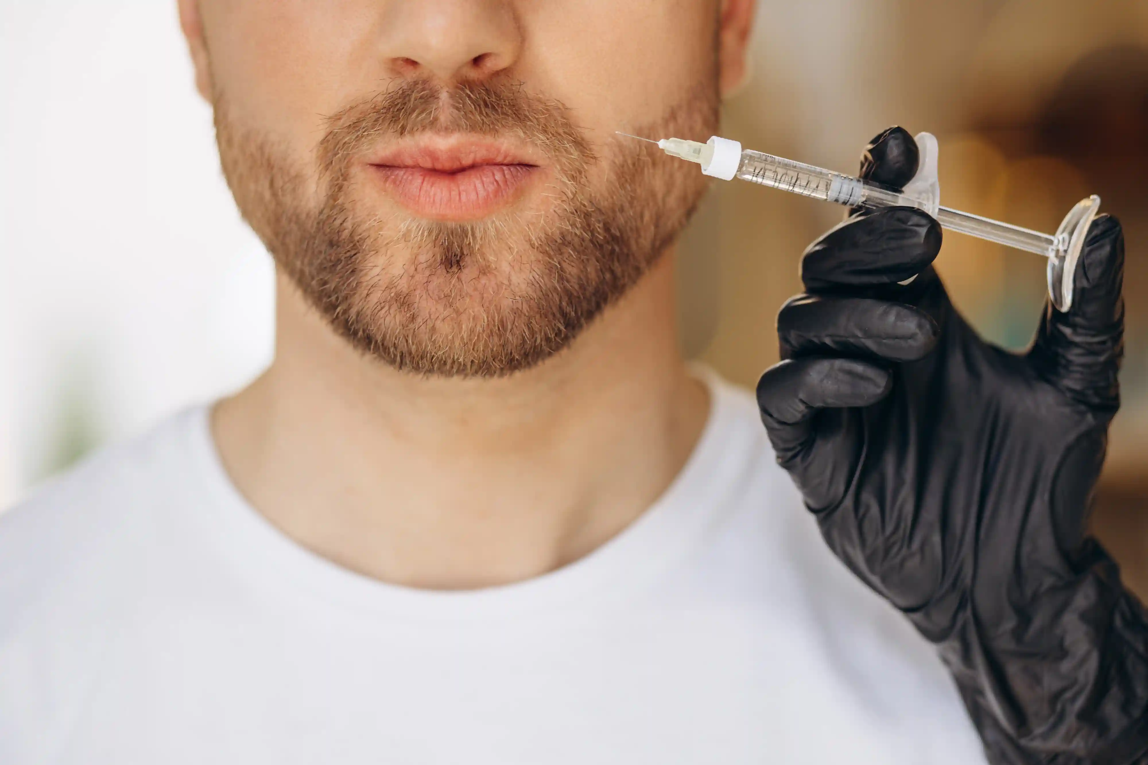 Beard PRP Treatment in Thrissur