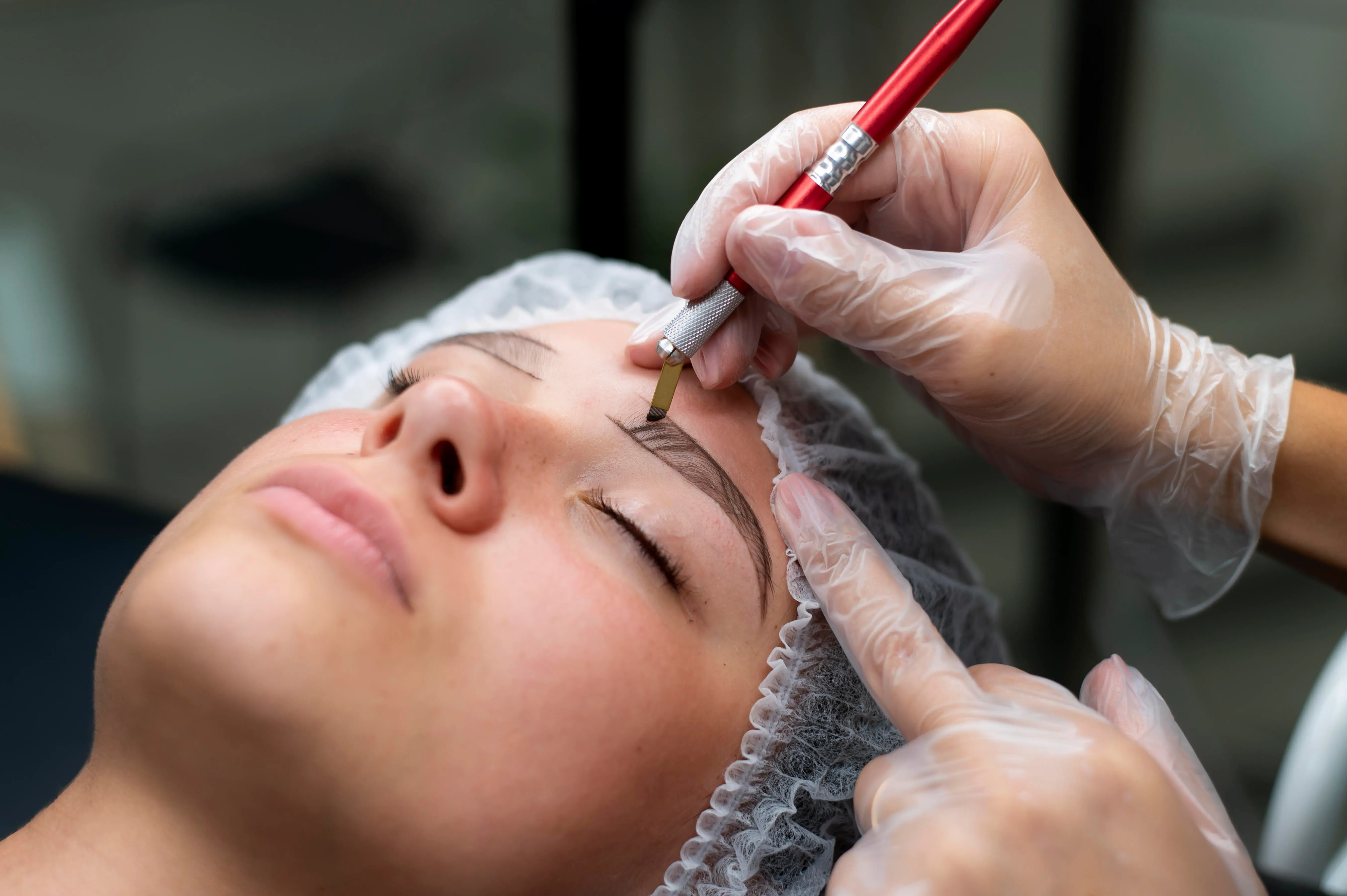 Eyebrow Transplantation in Thrissur