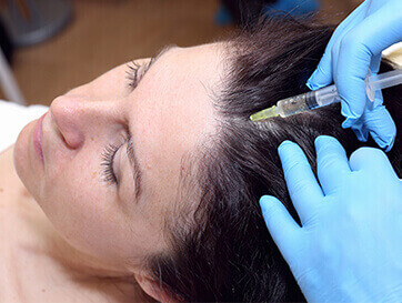 platelet rich plasma therapy for hair loss